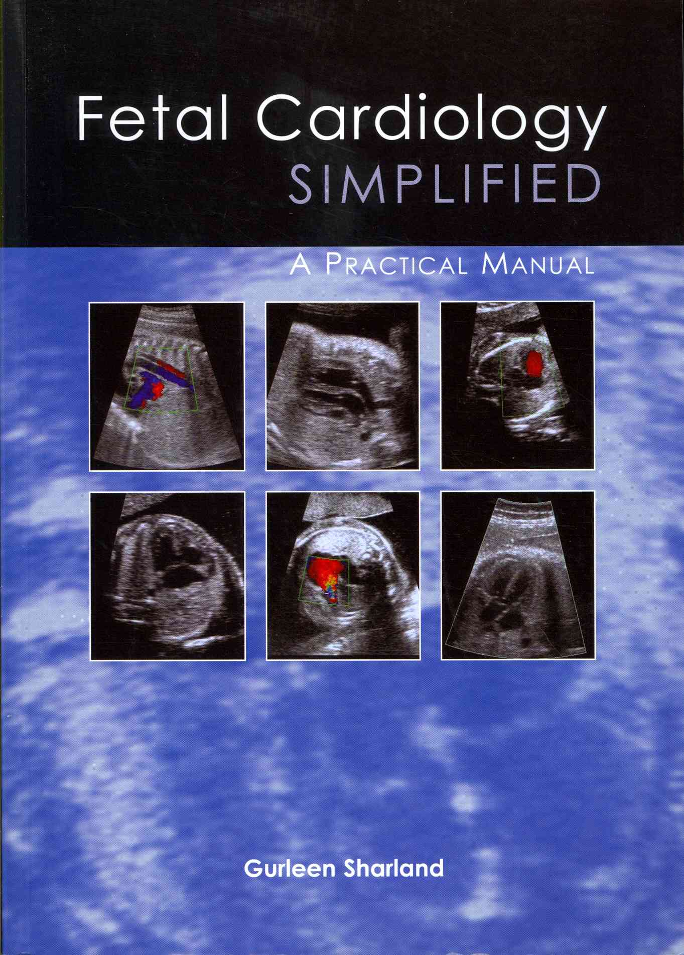 Ultrasonography